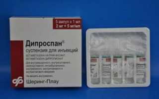 Лечение Дипроспаном: эффективные аналоги-заменители