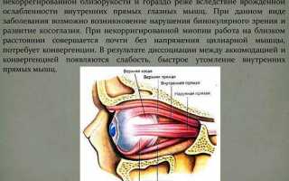 Причины, симптомы, виды и методы лечения астенопии глаз