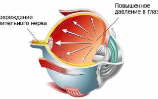 Как делать укол в глаз препаратом Озурдекс