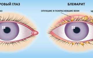 Показания к лечению глазными каплями Тобрекс для детей