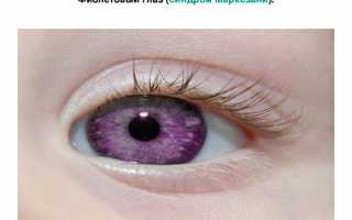 Бывают ли у людей фиолетовые глаза