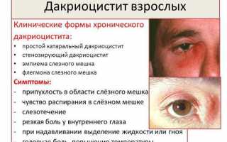 Как правильно применять глазную мазь Офлоксацин