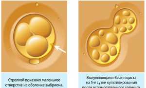 Хетчинг эмбрионов