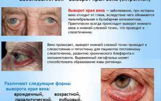 Поддержка органов зрения с помощью глазных капель Артелак Всплеск