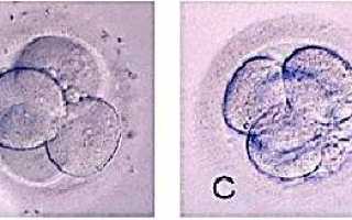 Классы эмбрионов при ЭКО