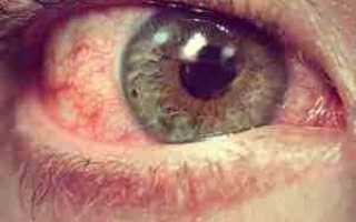 Отслоение сетчатки глаза — операция и отзывы пациентов