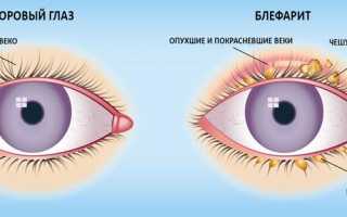 Применение Гентамициновой мази при лечении глаз