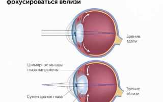 Виды нарушений аккомодации глаза и их лечение