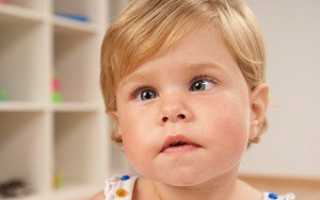 Как определить косоглазие у ребенка до года?