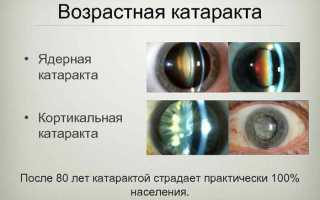 Действие и эффективность глазных капель Ретикулин