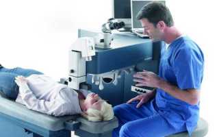 Операция на глаза лазером — преимущества, последствия и отзывы