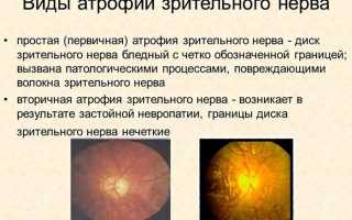 Особенности лечения ожогов глаз