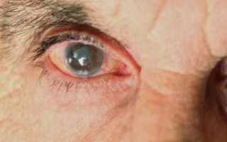 Глазные капли Таурин — сколько стоят в аптеках и как применять?