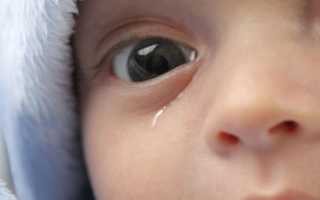 Если у ребенка слезится один глаз — причины и первая помощь