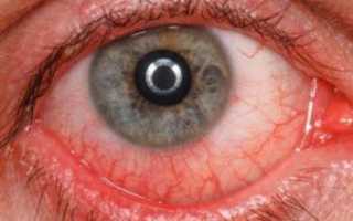 Глазные капли Полудан — инструкция по применению и отзывы о препарате