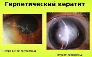Инструкция по применению глазной мази Ацикловир