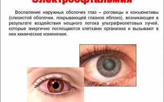 Обзор глазных капель для лечения ожога от сварки